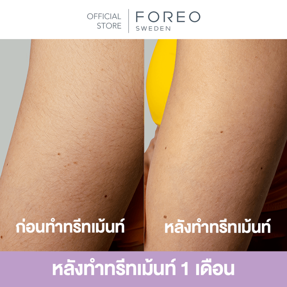 เครื่องกำจัดขน IPL FOREO PEACH 2 GO Lavender